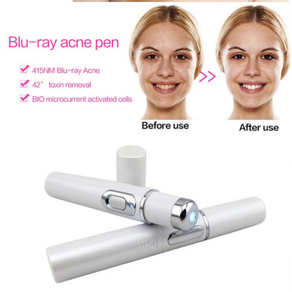 Blue Light Therapy Acne Laser Pen